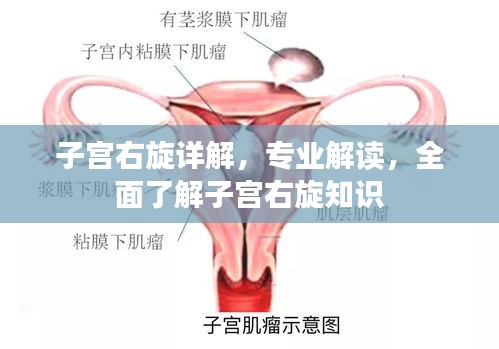 子宫右旋详解，专业解读，全面了解子宫右旋知识