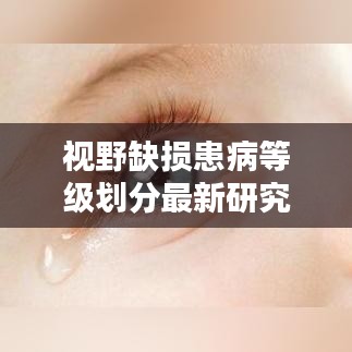 视野缺损患病等级划分最新研究成果揭秘